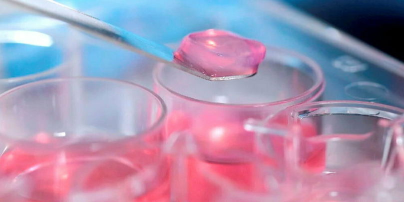 La bio-impression en 3D permet de multiples applications : greffes de peau, greffes osseuses, greffes gingivales, implants de traitement contre le diabète…
