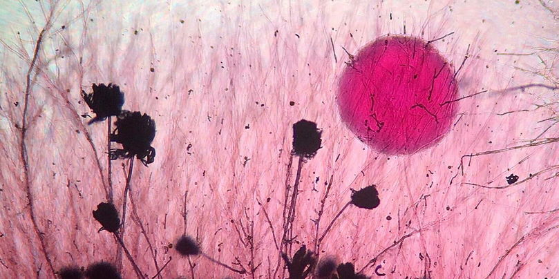 Le champignon « Aspergillus flavus » et colonie de levures (grossissement 40 x).
